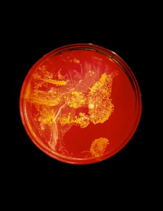Framed Print : Bacterial Print on Petri Dish Framed Print : Bacterial Print on Petri Dish