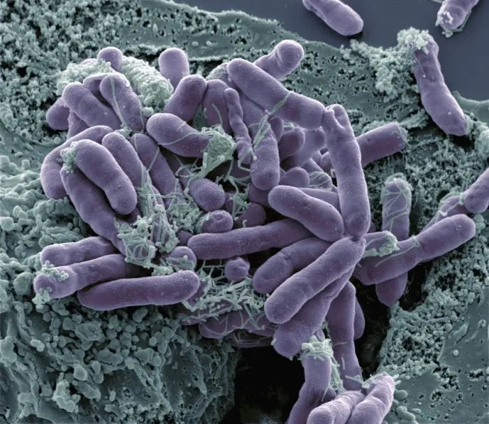 Framed Print : Print of Bacterial Contamination, SEM Image Framed Print : Print of Bacterial Contamination, SEM Image