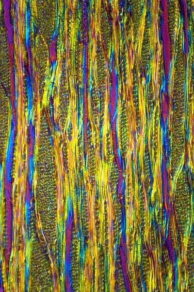 Beech tree stem, light micrograph