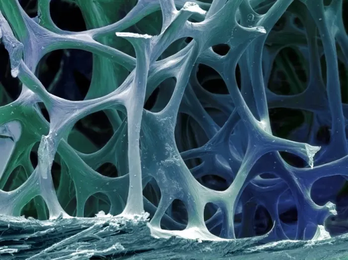 Framed Print : Cancellous Bone Tissue Print Framed Print : Cancellous Bone Tissue Print