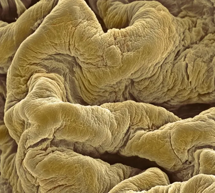 Framed Print : Bladder lining Print, SEM image of internal surface folds Framed Print : Bladder lining Print, SEM image of internal surface folds