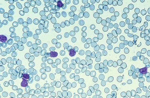 Blood cells, light micrograph