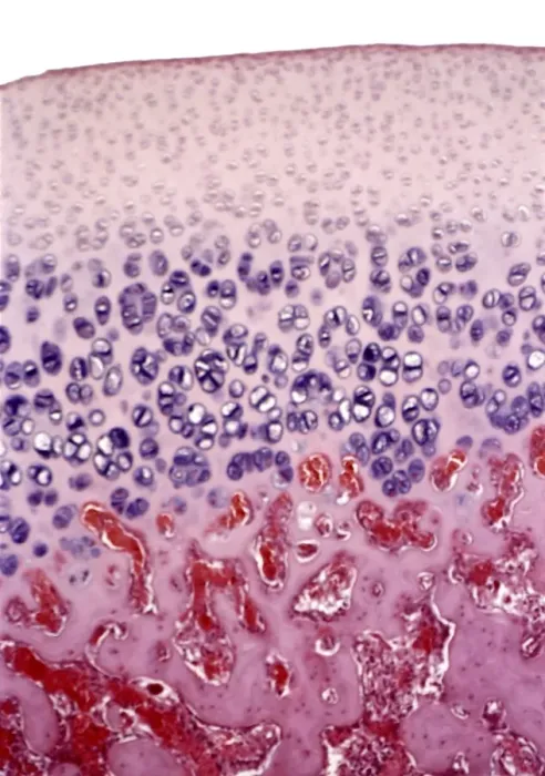 Framed Print : Bone growth, light micrograph Print