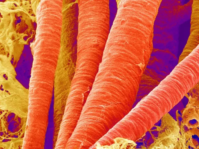 Framed Print : Coloured SEM Print of Brain Arteries Framed Print : Coloured SEM Print of Brain Arteries