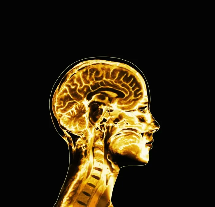 Framed Print : Brain Print: Side View of a Healthy Human Brain Framed Print : Brain Print: Side View of a Healthy Human Brain