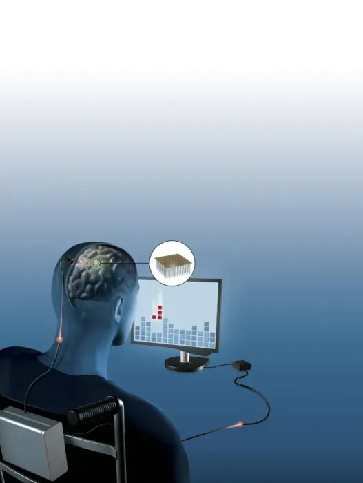 Framed Print : Brain-Computer Interface Print: A Paralysed Man Controls a Computer Game Framed Print : Brain-Computer Interface Print: A Paralysed Man Controls a Computer Game