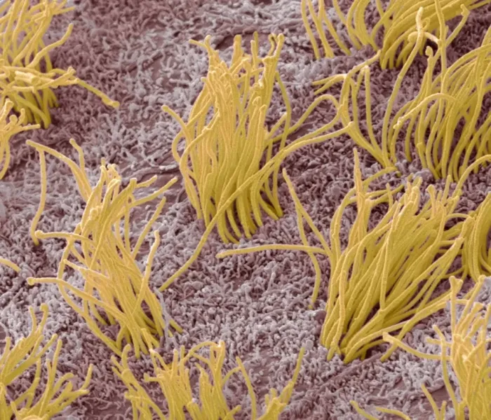 Framed Print : SEM Print of Brain Lining, Coloured Framed Print : SEM Print of Brain Lining, Coloured