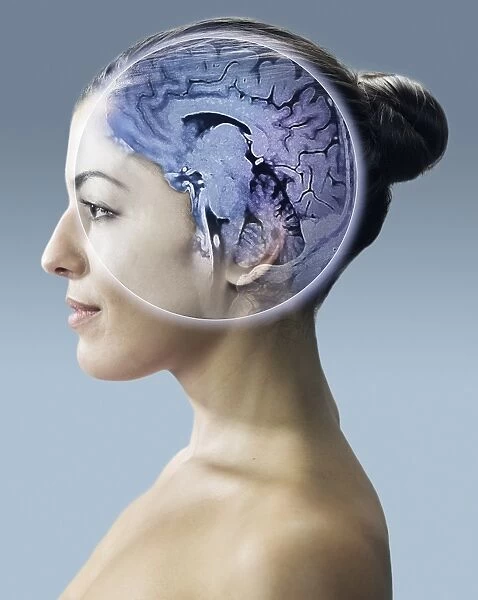 Brain scan, conceptual image C017  /  7392
