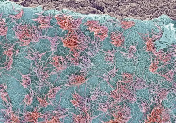 Framed Print : Brain Surface Print, SEM Image Framed Print : Brain Surface Print, SEM Image