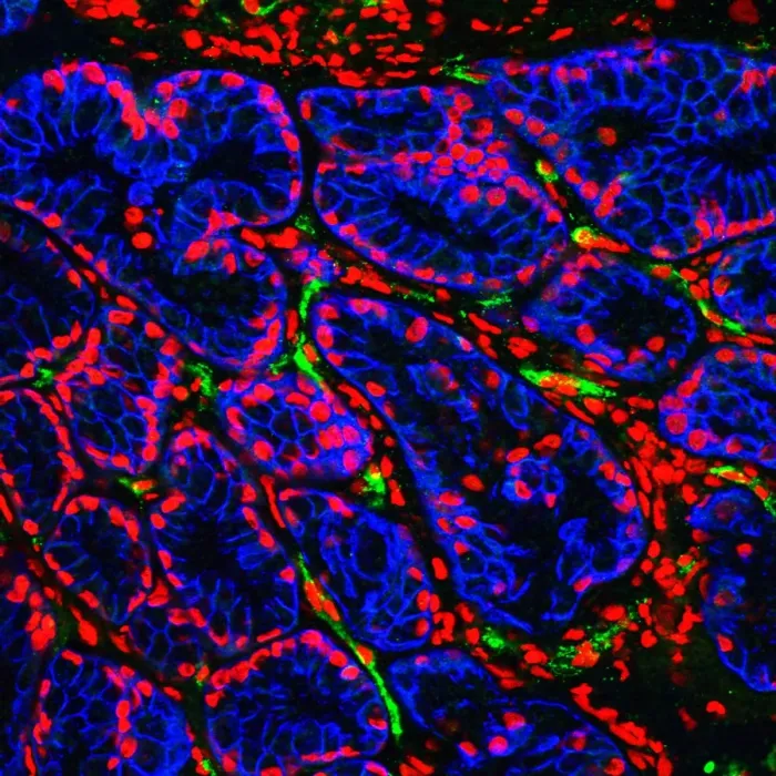 Framed Print : Fluorescence Confocal Light Micrograph Print of Brunners Glands in Duodenum Framed Print : Fluorescence Confocal Light Micrograph Print of Brunners Glands in Duodenum