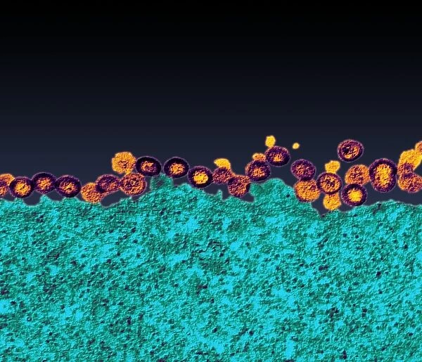 Budding HIV particles, TEM