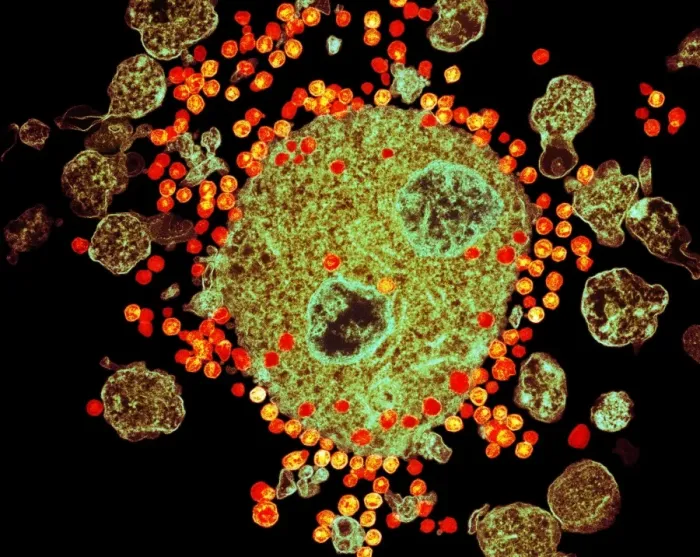 Framed Print : Budding HIV particles Print Framed Print : Budding HIV particles Print