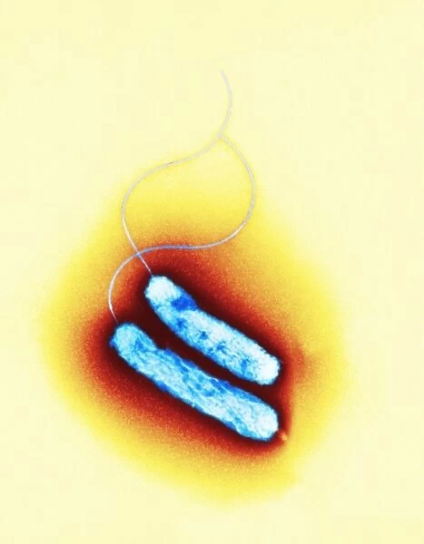 Campylobacter oral bacteria, TEM