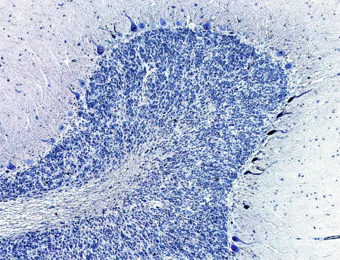 Framed Print : Coloured Light Micrograph Print of Cerebellum Tissue Framed Print : Coloured Light Micrograph Print of Cerebellum Tissue