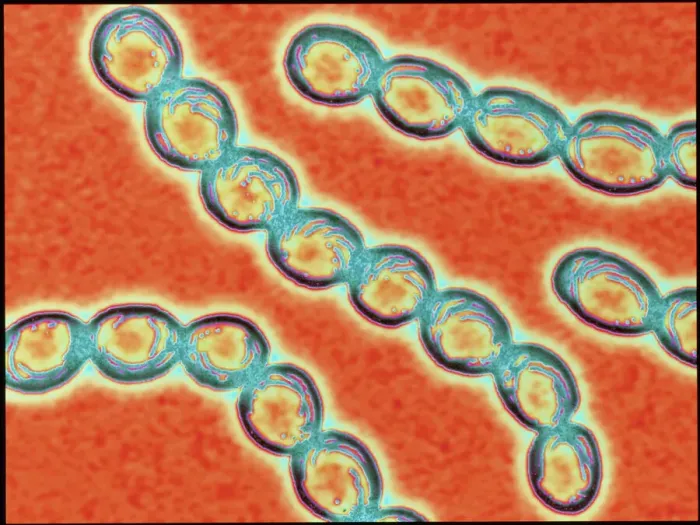 Framed Print : Streptococcus pyogenes bacteria chains Print Framed Print : Streptococcus pyogenes bacteria chains Print