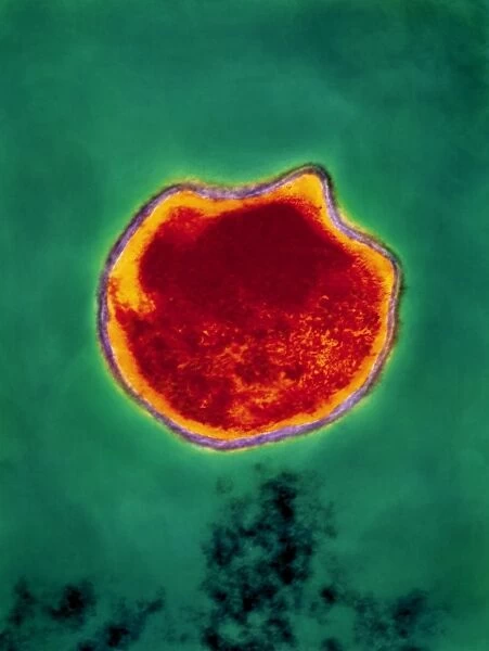 Chlamydia pneumoniae bacterium