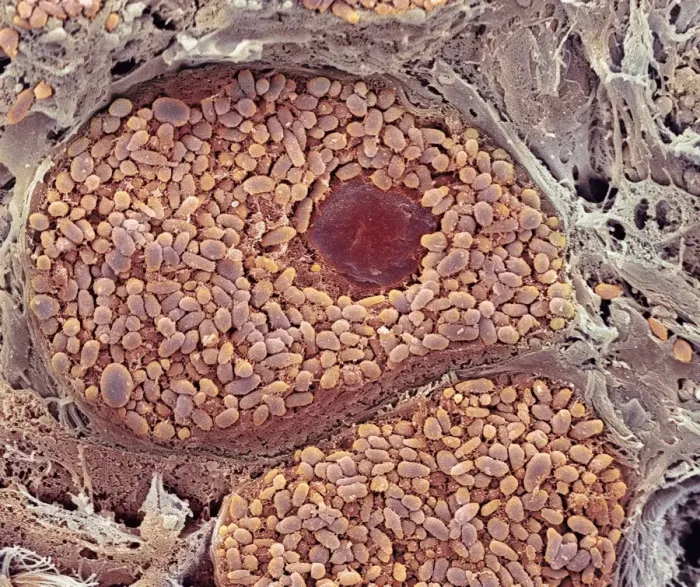 Framed Print : SEM Print of Choroid Layer