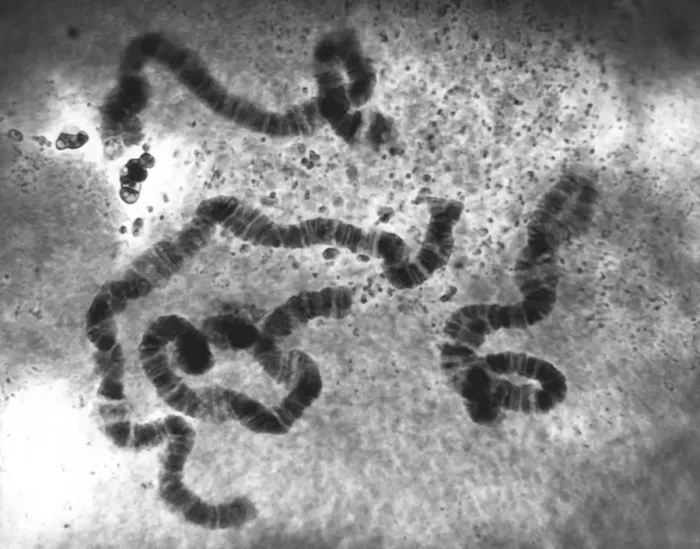 Framed Print : Chromosomes Print, Light Micrograph Framed Print : Chromosomes Print, Light Micrograph