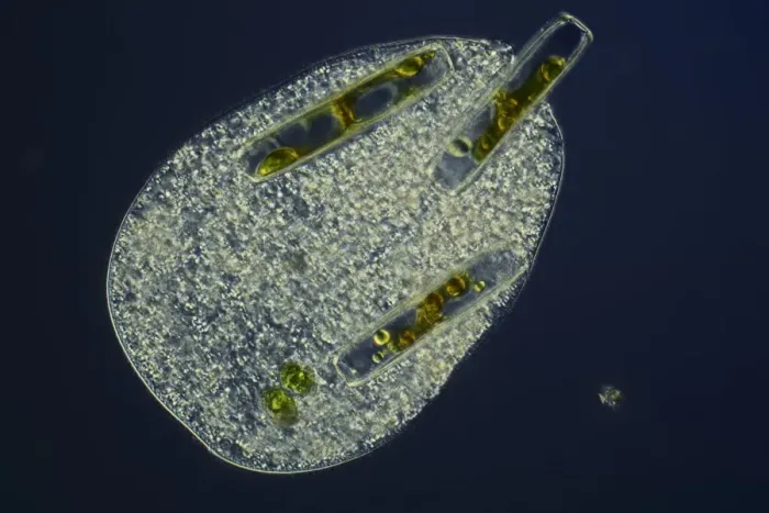 Framed Print : Ciliate protozoan ingesting algae Print Framed Print : Ciliate protozoan ingesting algae Print