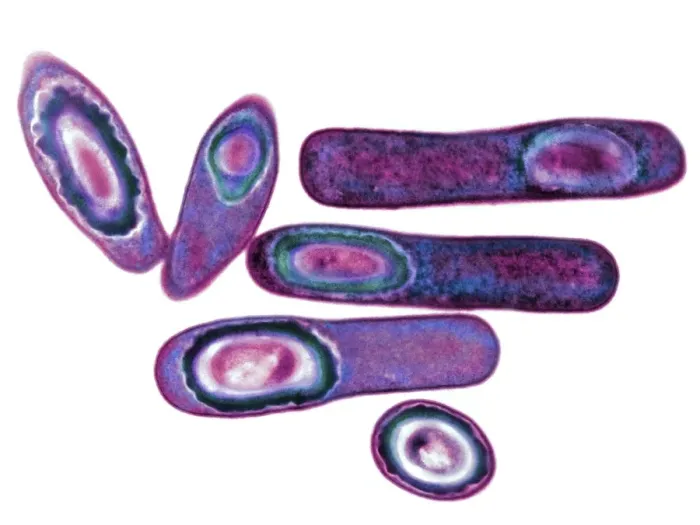 Framed Print : TEM Clostridium difficile print, 10cm wide