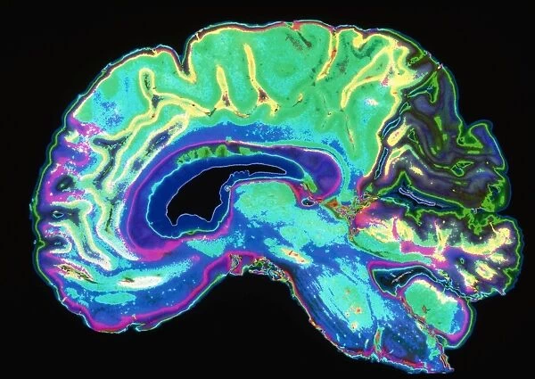Coloured sagittal slice through a healthy brain