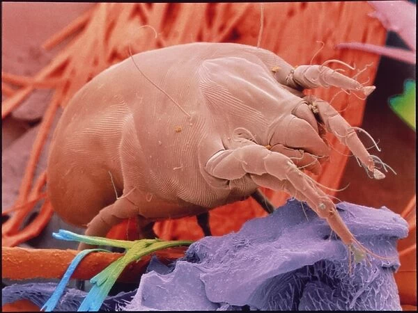 Coloured SEM of a dust mite, Dermatophagoides sp