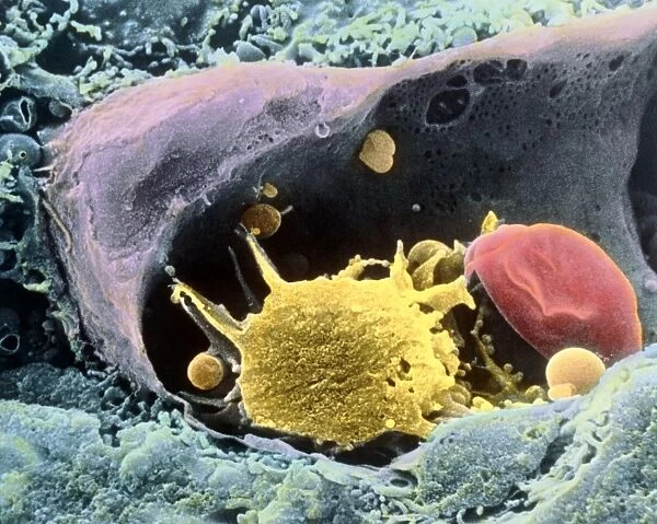 Coloured SEM of a monocyte in a blood capillary
