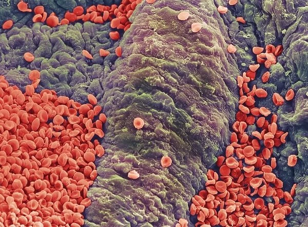 Coloured SEM of red blood cells on vessel wall