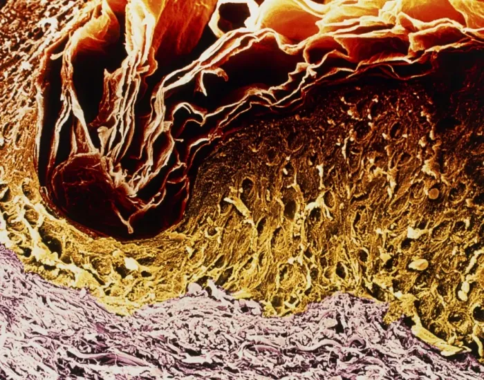 Framed Print : Coloured SEM Print of Human Skin Section Framed Print : Coloured SEM Print of Human Skin Section