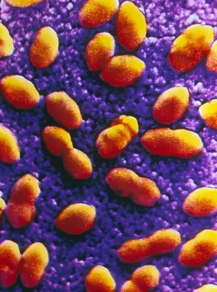 Coloured SEM of streptococcus pneumoniae
