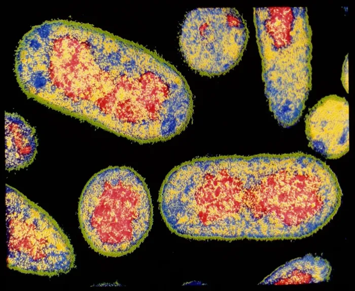 Framed Print : Coloured TEM Print of E. coli Bacterium Framed Print : Coloured TEM Print of E. coli Bacterium