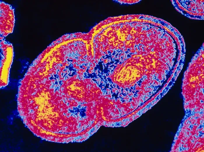 Framed Print : Coloured TEM Print of Enterococcus faecalis Bacteria Framed Print : Coloured TEM Print of Enterococcus faecalis Bacteria