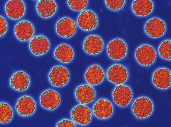 Coloured TEM of hepatitis B virus particles