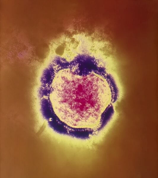 Coloured TEM of the measles virus