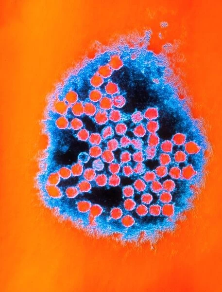 Coloured TEM of rhinoviruses, cause of common cold