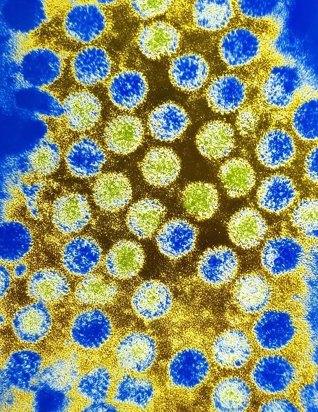 Coloured TEM of rotaviruses