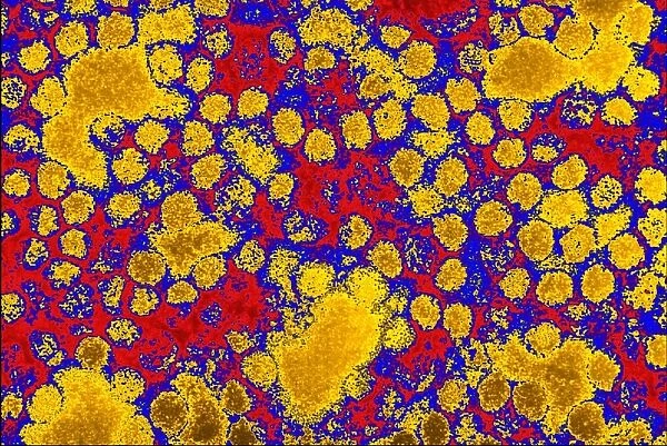 Coloured TEM of yellow fever viruses