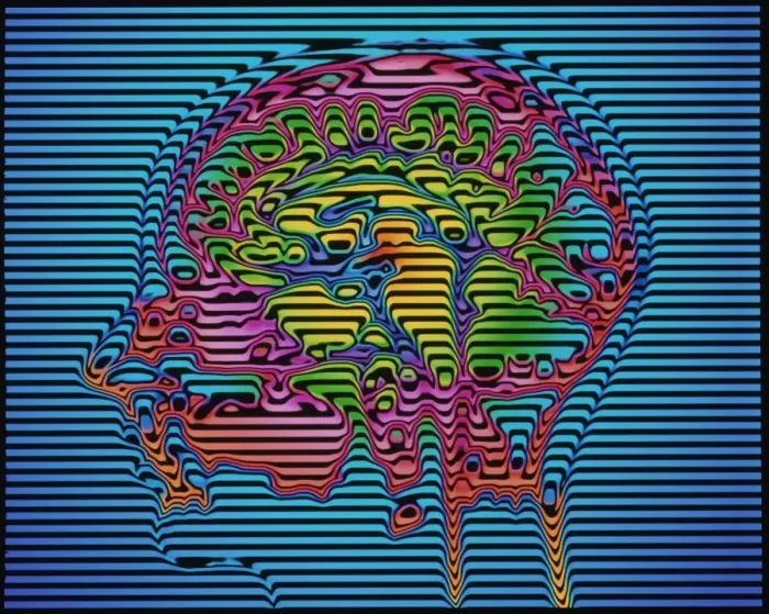 Framed Print : Computer-enhanced MRI brain scan Print (side view) - Healthy Brain Framed Print : Computer-enhanced MRI brain scan Print (side view) - Healthy Brain