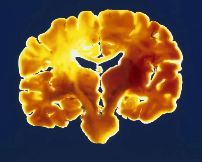 Framed Print : Coronal Slice of a Human Brain Print Framed Print : Coronal Slice of a Human Brain Print