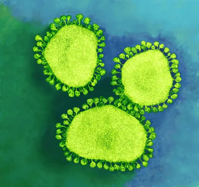 Framed Print : TEM Coronavirus particles Print Framed Print : TEM Coronavirus particles Print