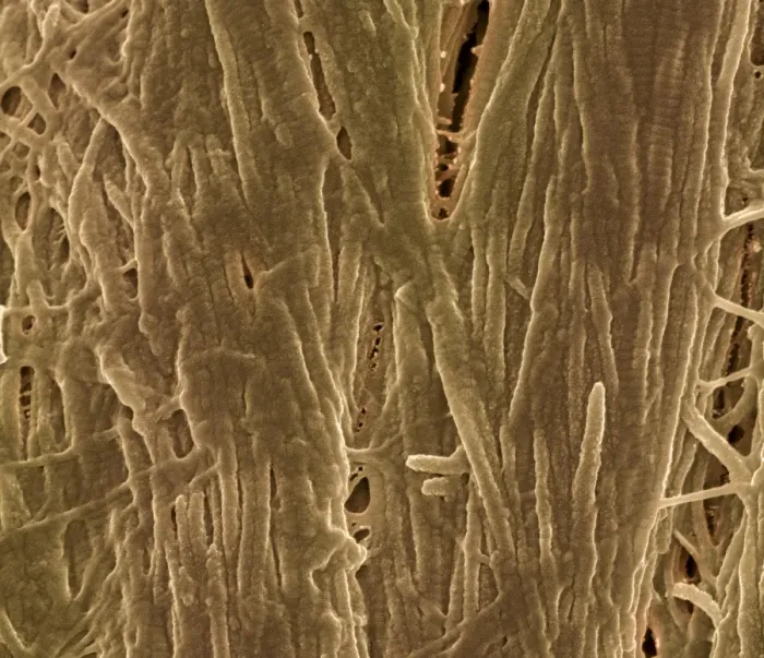 Framed Print : Cortical Bone Print (SEM) Framed Print : Cortical Bone Print (SEM)