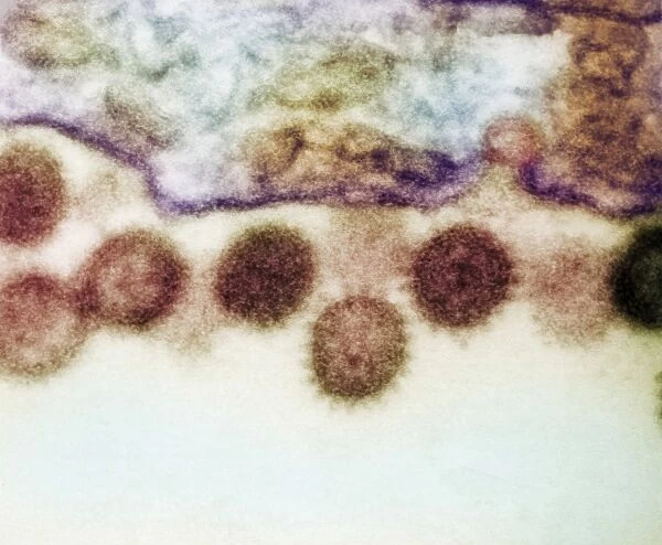 Crimean-Congo haemorrhagic fever virus
