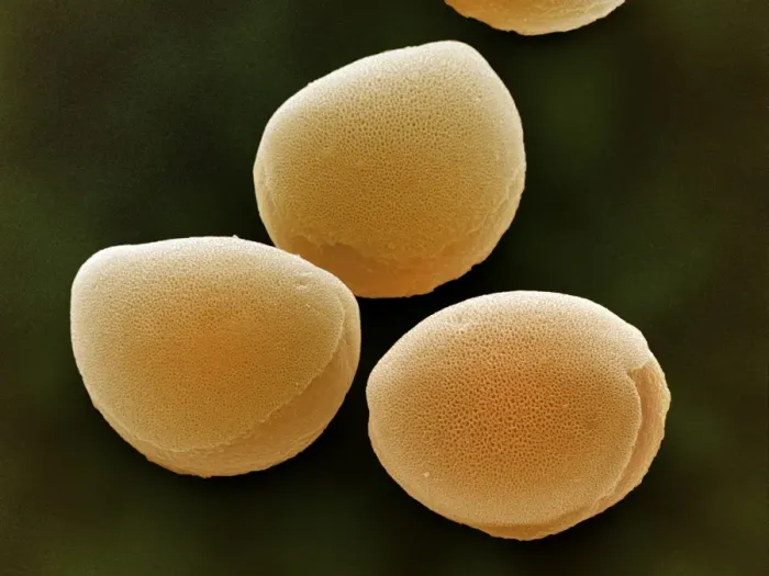 Framed Print : High-resolution SEM print of daffodil pollen grains Framed Print : High-resolution SEM print of daffodil pollen grains