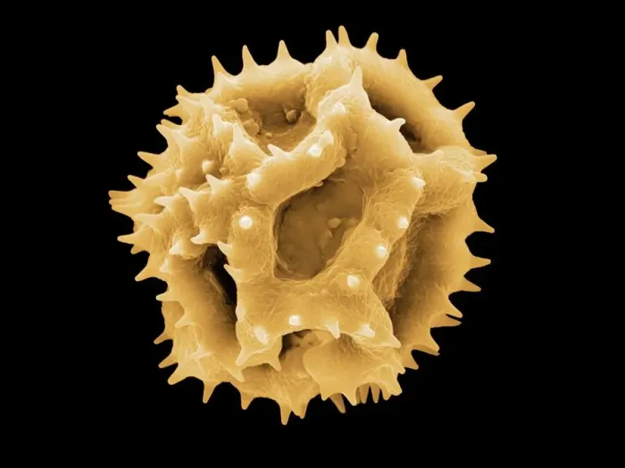 Framed Print : Dandelion pollen grain Print, SEM image Framed Print : Dandelion pollen grain Print, SEM image