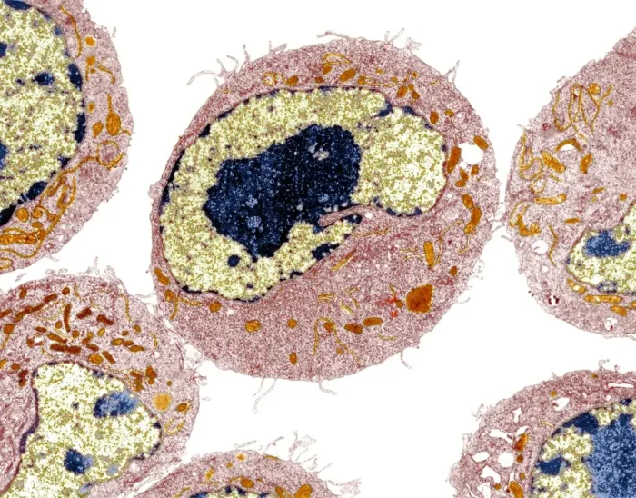 Framed Print : Dendritic cell print, TEM image of skin cells