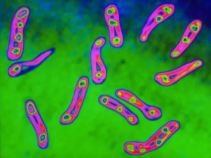 Framed Print : TEM Diphtheria bacteria Print Framed Print : TEM Diphtheria bacteria Print