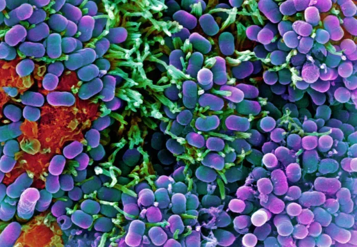 Framed Print : Print of E. coli bacteria under SEM, a purple rod-shaped bacterium Framed Print : Print of E. coli bacteria under SEM, a purple rod-shaped bacterium