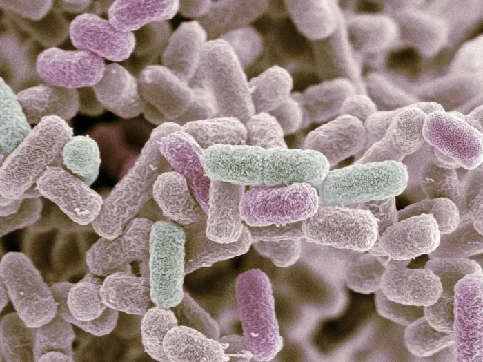 Framed Print : SEM Print of E. coli Bacteria