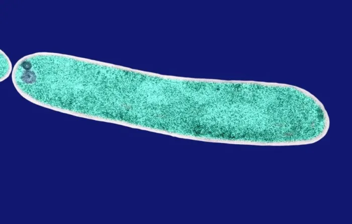 Framed Print : Print of TEM E. coli bacterium, a Gram-negative rod-shaped microorganism Framed Print : Print of TEM E. coli bacterium, a Gram-negative rod-shaped microorganism