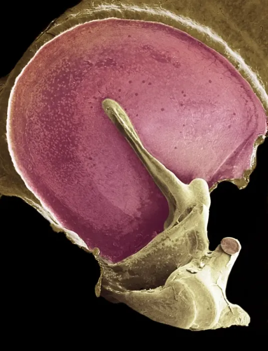 Framed Print : Coloured SEM Eardrum Print Framed Print : Coloured SEM Eardrum Print